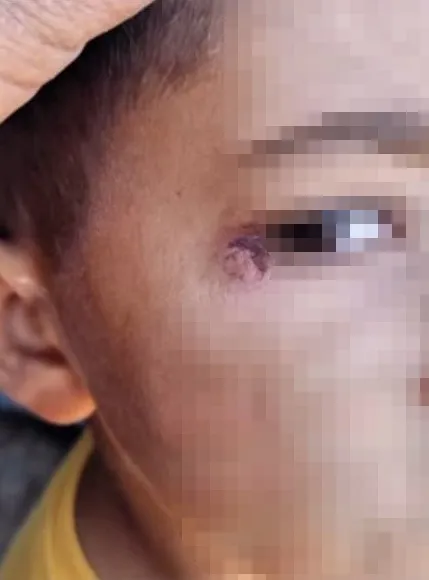 Öğrencinin yüzünde sigara söndüren temizlik görevlisi tutuklandı
