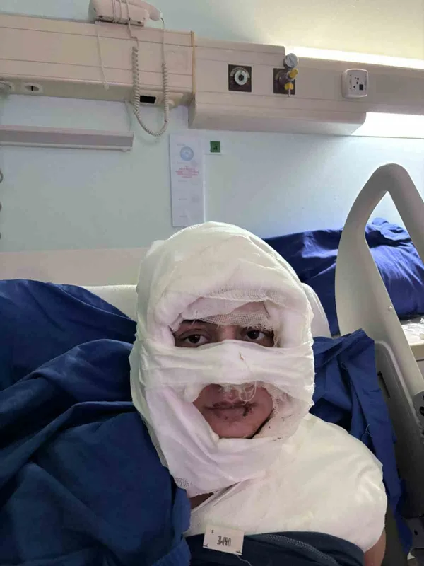 Kadıköy’de akıl almaz olay: Genç kadın başka bir kadın tarafından ateşe verildi
