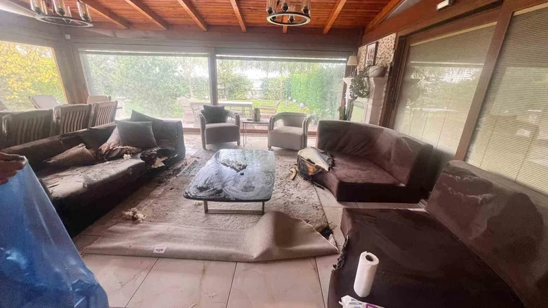 Dekoratif şömine bomba gibi patladı, vücudunun yüzde 30’u yandı: 