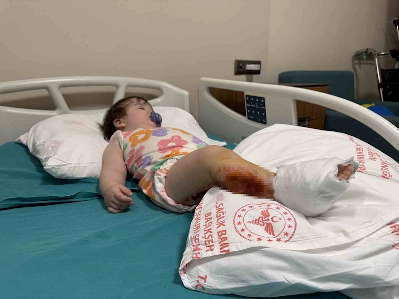 Üzerine çaydanlık devrilen 1 yaşındaki bebek dehşeti yaşadı, vücudunun yüzde 15’i yandı
