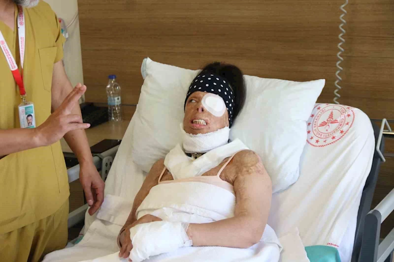 Genç kadının hayatı kezzapla karardı
