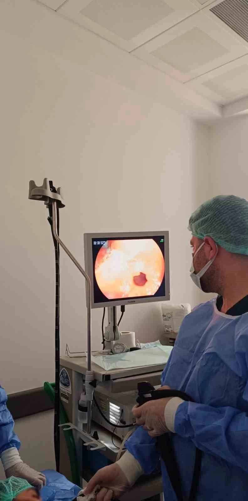 Çermik Devlet Hastanesinde endoskopi ve kolonoskopi ünitesi hizmet vermeye başladı
