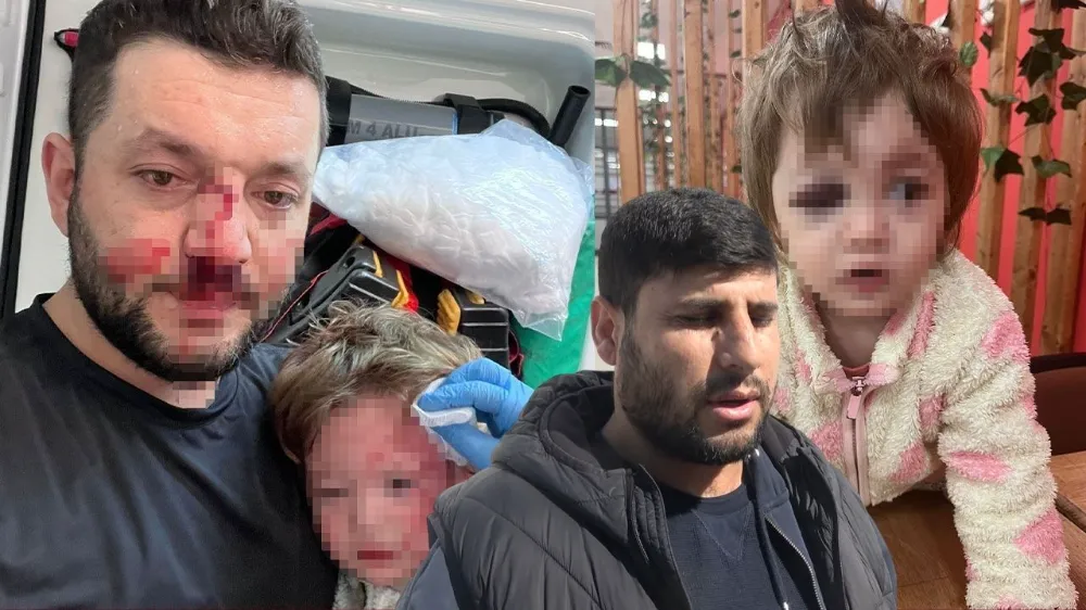 Yalova’da komşu dehşeti: 14 aylık bebeğin kafatası çatladı